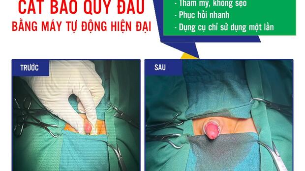CON BẠN CÓ BỊ HẸP BAO QUY ĐẦU