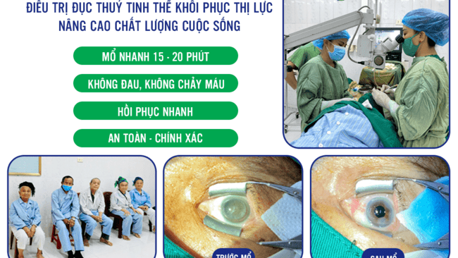 PHẪU THUẬT PHACO